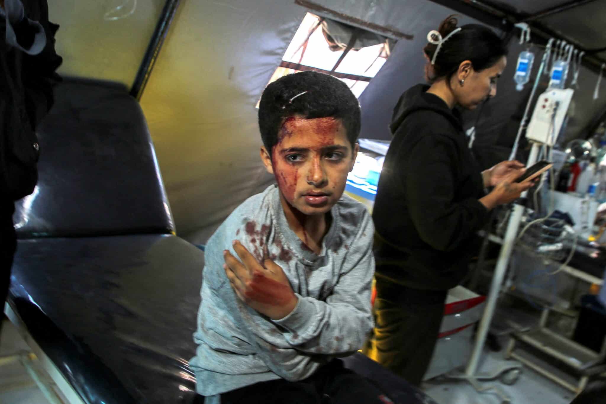 A Palestinian boy wounded in an Israeli strike waits to receive treatment at a hospital as Israeli forces launch a ground and air operation in the eastern part of Rafah, amid the ongoing Israel-Hamas war, in Rafah, in the southern Gaza Strip, May 7, 2024. (OSV News photo/Hatem Khaled, Reuters)